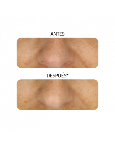 IROHA MASCARILLA PEELING ACIDO GLICOLICO