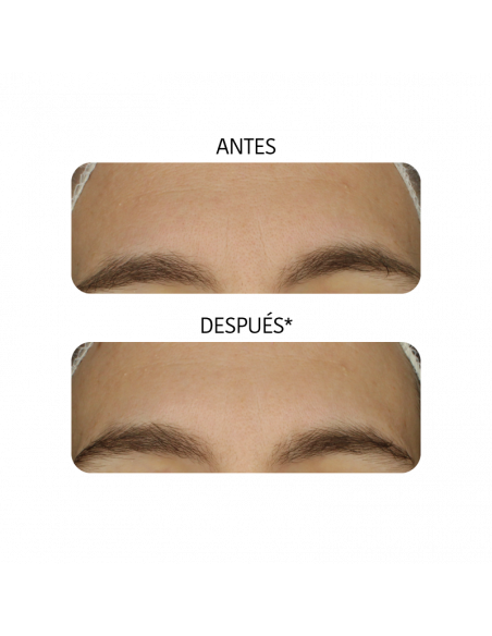 IROHA MASCARILLA EQUILIBRANTE CARBÓN Y ÁCIDO HIALURÓNICO