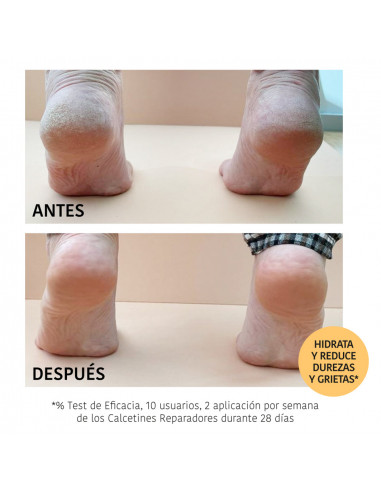 IROHA CALCETINES MASCARILLA REPARADORES CON MELOCOTÓN