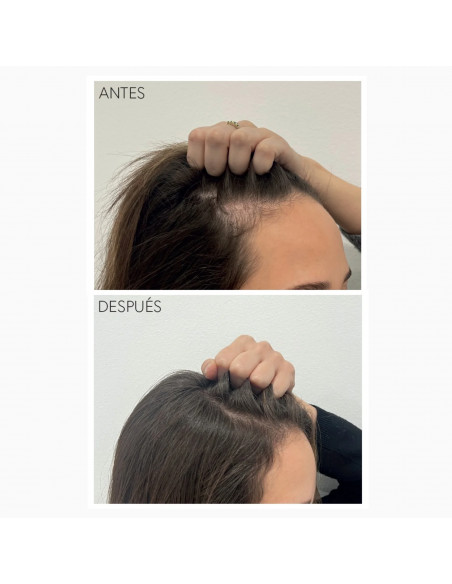 MONCHO MORENO RAPUNHAIR 70ML